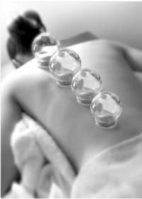 Cupping Treatment Boca Raton