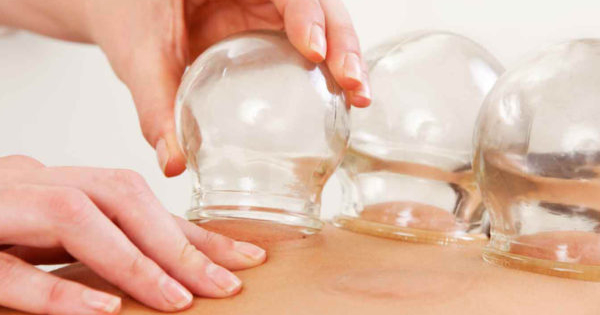 Cupping Therapy Benefits for Athletes