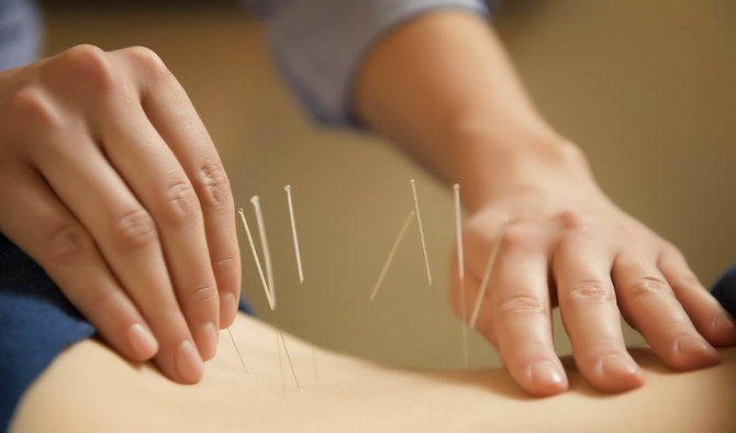 What can Acupuncture Treat? Learn the Wonderful Benefits of Acupuncture