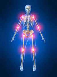 Benefits of acupuncture for arthritis