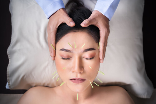 Benefits of Cosmetic Acupuncture: 5 Reasons it’s Not Scary!